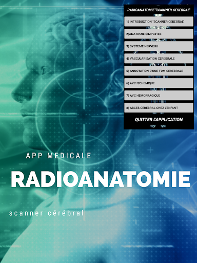 radio-anatomie"scanner cérébra Screen 2
