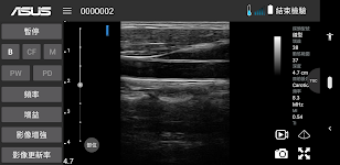 screenshot of MediConnect – ASUS Ultrasound