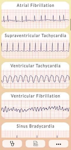 Android application ECG Guide screenshort