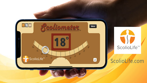 Scoliometer App screenshot 15
