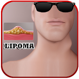 Lipoma Disease Solution icon