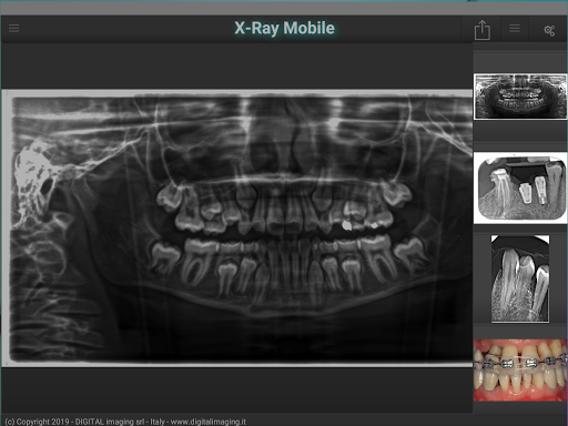 X-Ray Mobile screenshot for Android