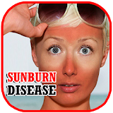 Sunburn Disease Problem icon