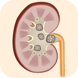 Symbolbild für Kidney Stone Symptoms & Treatm