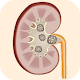 Kidney Stone Symptoms & Treatm