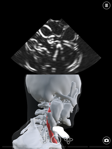 Deepscope Ultrasound Simulator