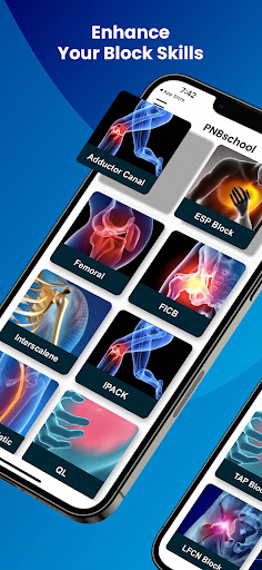 Android application PNBschool Anesthesia Blocks screenshort