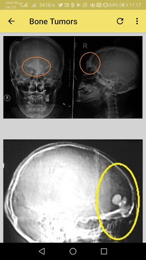 Musculoskeletal X-ray App Screen 3