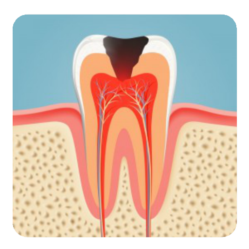 Dental Caries tips  Icon