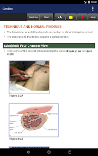 Pocket Atlas of Emergency Ultrasound, 2nd Edition Screenshot