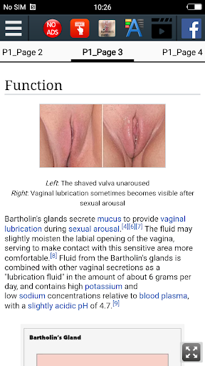 Bartholin gland EducationApp