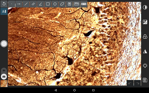 Android application EPview screenshort
