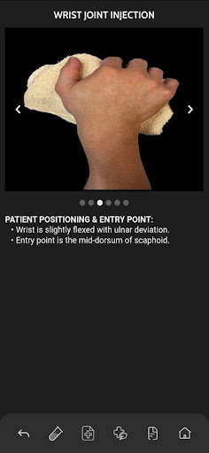 VBS RadGuide: MSK Injections Screen 2