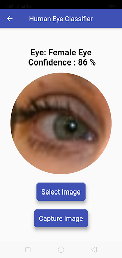 Human Eye Gender Classificatio