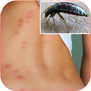 Top 41 Education Apps Like Home Remedies for Insect Bites - Best Alternatives