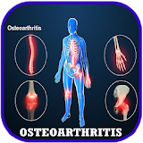 Osteoarthritis Disease Problem icon