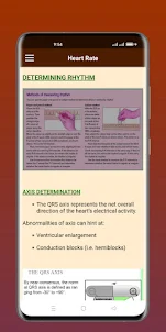 ECG Rhythm & Interpretation