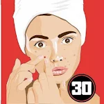Cover Image of ดาวน์โหลด Cure Acne (Pimples) in 30 Days  APK
