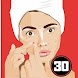 Cure Acne (Pimples) in 30 Days - Androidアプリ