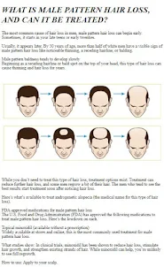 How to Treat Baldness