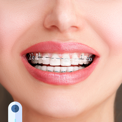 Braces Photo Editor logo