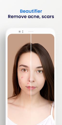 AI Photo Enhancer - PhotoUp Screen 2