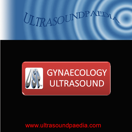 Gynecology Ultrasound 1.0 Icon