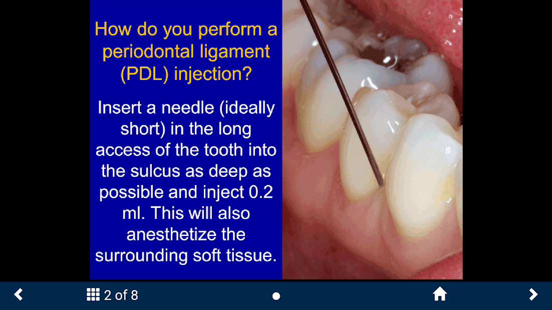 Captura 6 Dental Anesthesia - SecondLook android