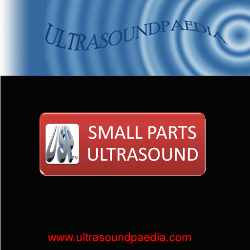 Small Parts Ultrasound 1.0 Icon