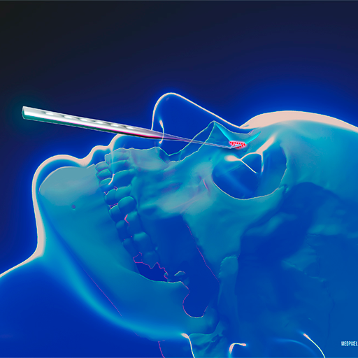 IPO - Cirurgia do Seio Frontal logo