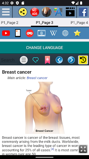Breast disease