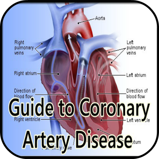 Guide Coronary Artery Disease  Icon