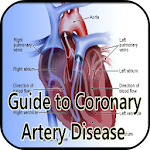 Guide Coronary Artery Disease Apk