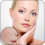 Pimple Remover : Face Maker icon