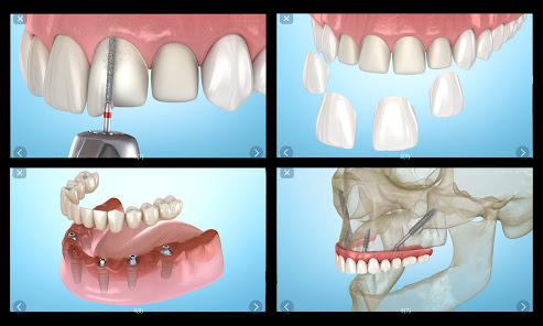 Captura 20 Ilustraciones dentales android