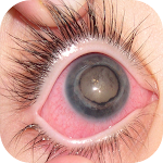Cover Image of Descargar Eye Diseases  APK