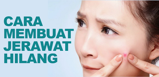 Cara Menghilangkan Jerawat