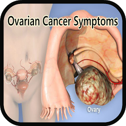 Icon image Ovarian Cancer Symptoms
