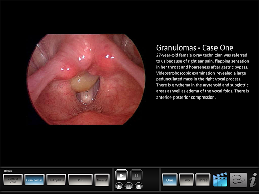 Reflux Screen 3