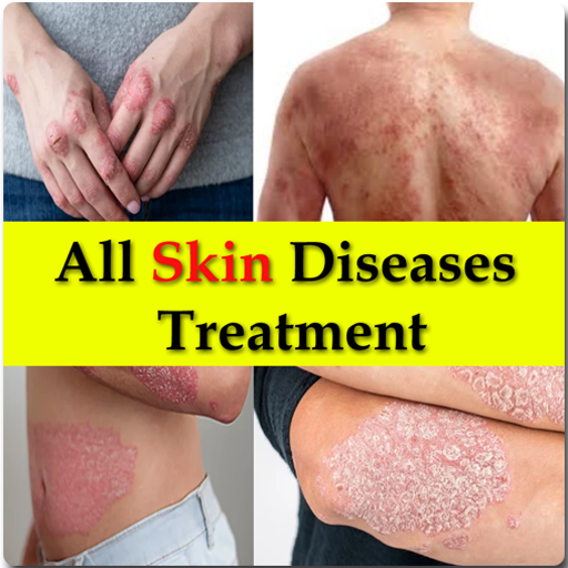 All Skin Diseases - Treatment