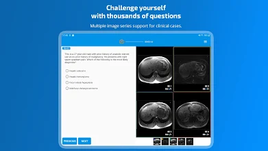 Qevlar Radiology Apps On Google Play