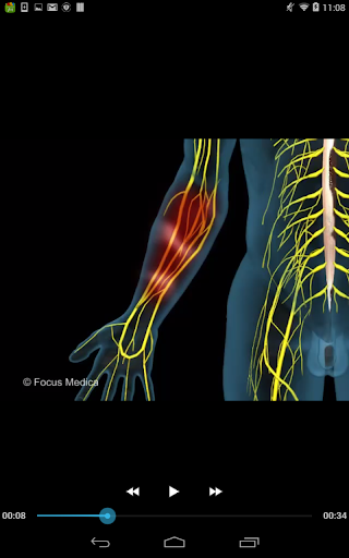FAQs in Neuropathic pain Screen 3