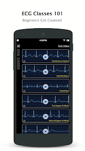 ECG Pro - Real World ECG / EKG Cases Screenshot