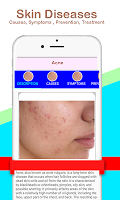 screenshot of Skin Diseases and Treatment