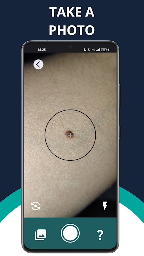 Android application DermObserver: dermatology scan screenshort