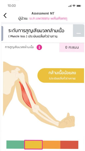 NCI Nutrition Screen 2