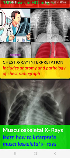 X RAY Interpretation - cases screenshot 23
