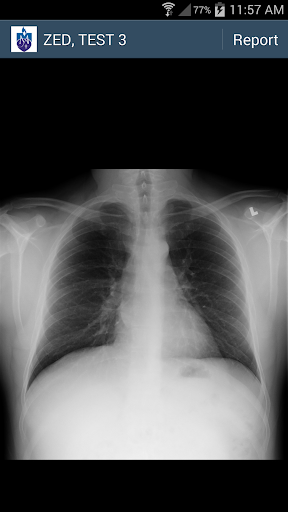 SVHS Image Screen 3