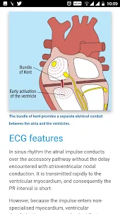 ECG Basics - Full