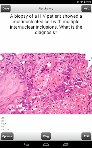 USMLE Step 2 CK Cards Lite